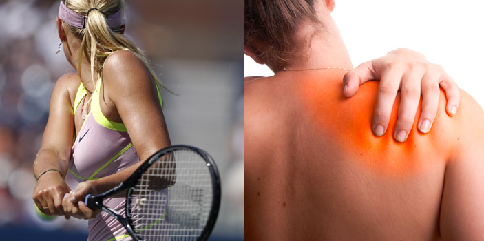 Schultersteife (Capsulitis adhaesiva)